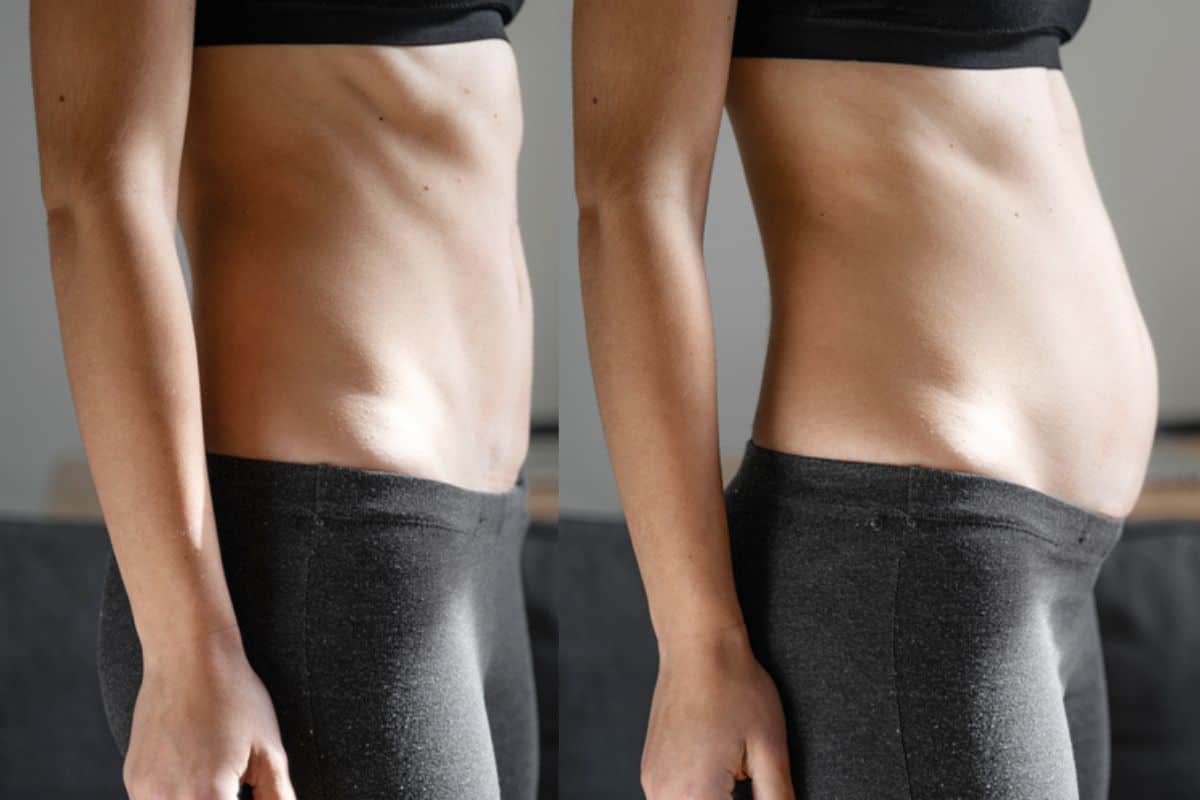 How long does diastasis recti take to improve Shropshire?