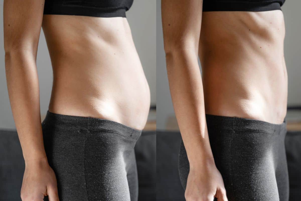 Post-Pregnancy: What Happens to Your Abdominal Muscles After Birth Shropshire