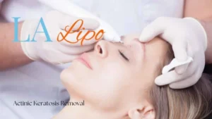 Woman receiving Actinic Keratosis Removal Treatment Shropshire