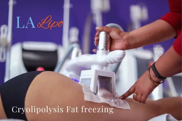 women getting fat freezing Shropshire