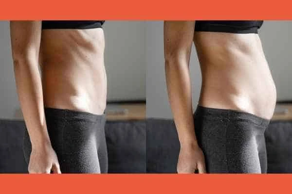 LA-EMS Body Sculpting results Shropshire