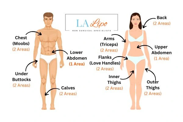 LA LIPO Cryolipolysis Areas Shropshire