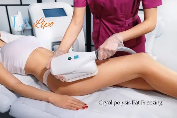 Woman receiving coolsculpting Shropshire treatment on her thighs