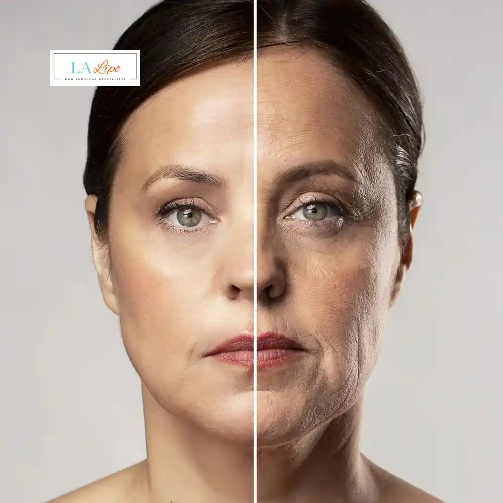 How Can You Tell If Non-Surgical Skin Tightening Is Right for You Shropshire?