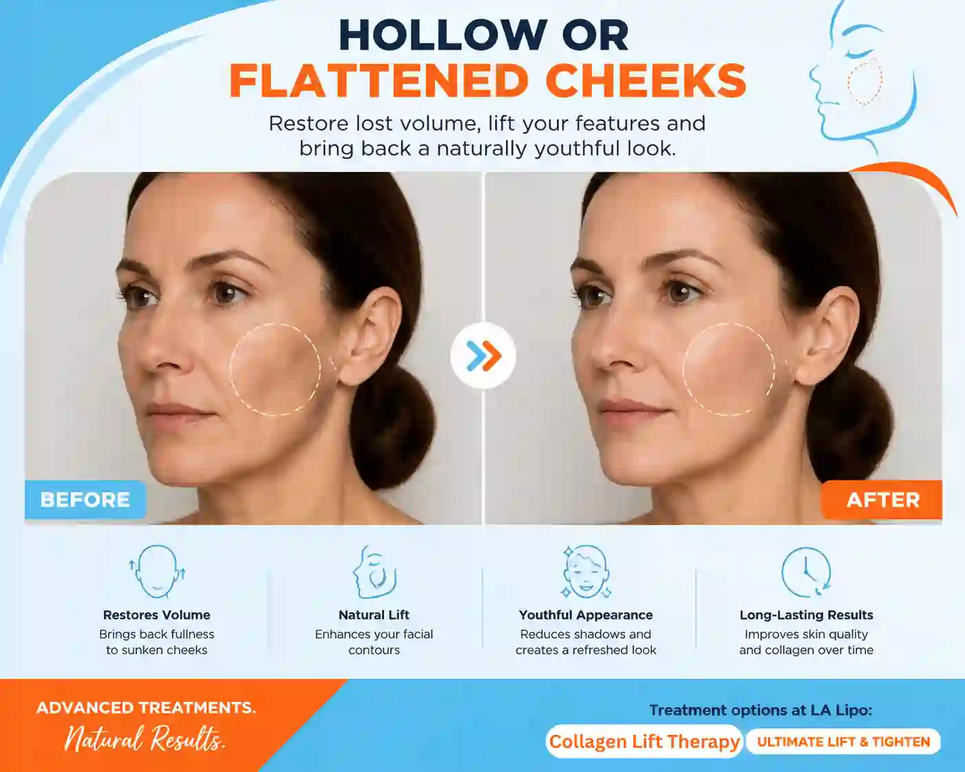 Sign #4: Hollow or Flattened Cheeks Shropshire