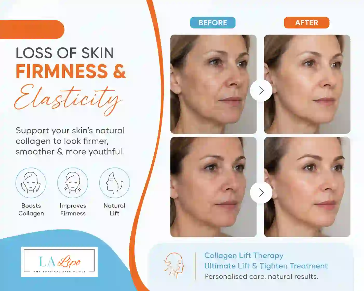 Sign #7: Loss of Skin Firmness and Elasticity Shropshire